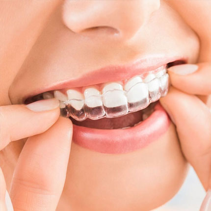 Suresmile